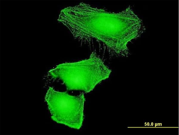 Monoclonal Mouse anti-Human CUL2 / Cullin 2 Antibody (clone 4G11, IF, WB)