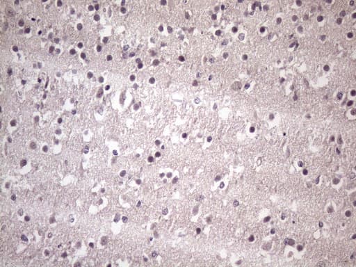 HSF2 Antibody (aa74-324, clone OTI2E11)