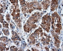 Monoclonal Mouse anti-Human HMRF1L / MTRF1L Antibody (clone OTI1H5, IHC, IF, WB)