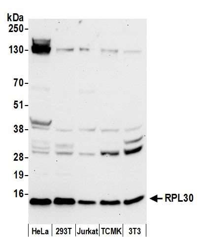 Polyclonal Rabbit anti-Human RPL30 / Ribosomal Protein L30 Antibody (aa65-115, WB)