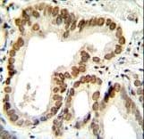 Polyclonal Rabbit anti-Human BTG2 Antibody (aa33-61, IHC, WB)