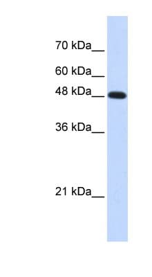 Polyclonal Rabbit anti-Human POLM / DNA Polymerase Mu Antibody (C-Terminus, WB)
