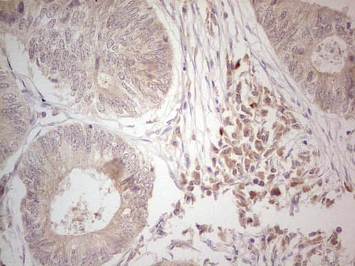 Hairless / HR Antibody (aa946-1189, clone OTI1D9, Carrier-free)