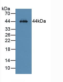 ASGR1 / ASGPR Antibody (aa80-281, APC)