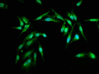Polyclonal Rabbit anti-Human ARL1 Antibody (IHC, IF)