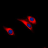 INSR / Insulin Receptor Antibody (phospho-Tyr1361)