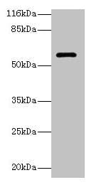 Polyclonal Rabbit anti-Human GK3 / Glycerol Kinase 3 Antibody (IHC, WB)