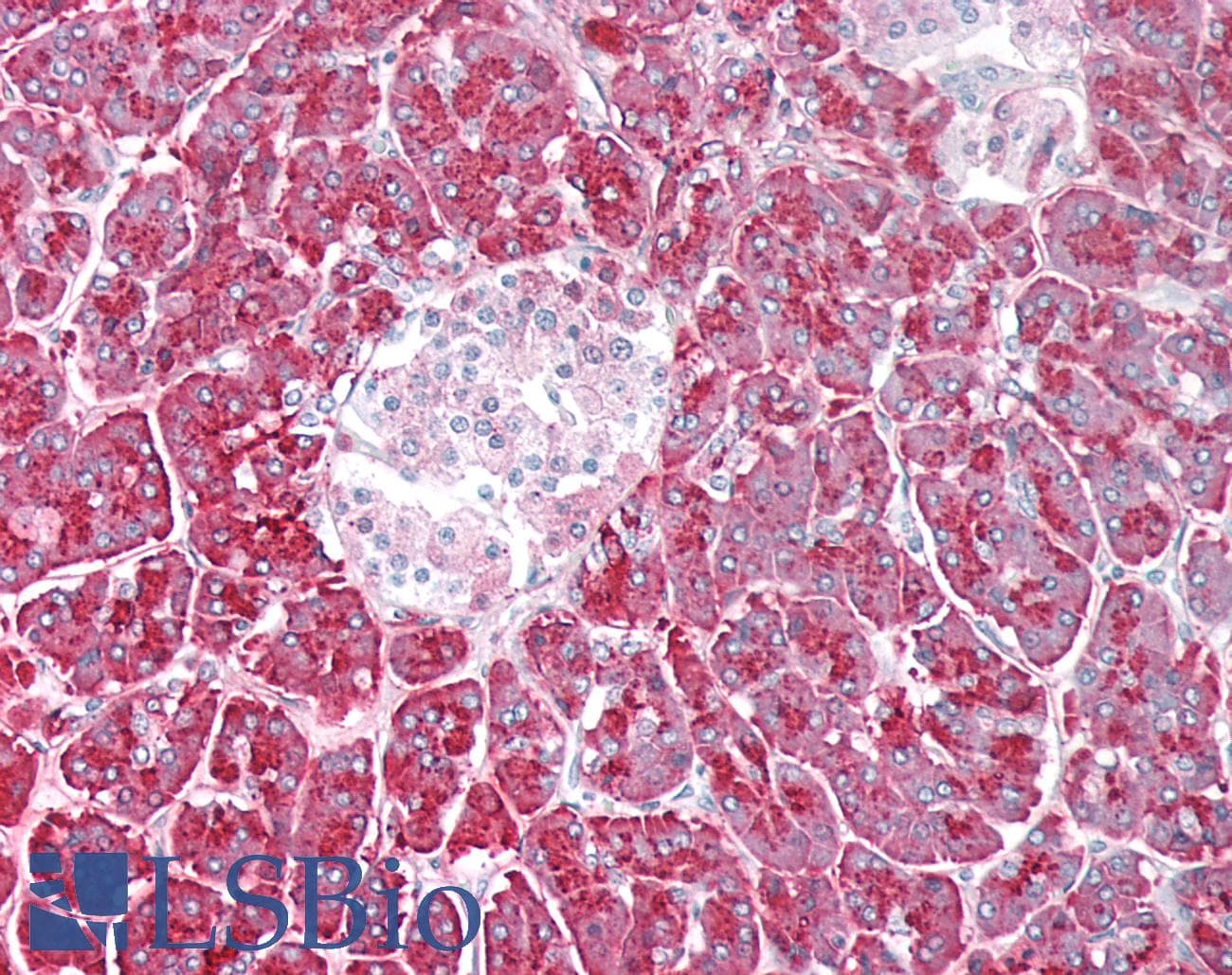 IHC-plus™ Polyclonal Rabbit anti-Human PNLIP / PL / Pancreatic Lipase Antibody (IHC, WB)