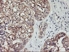 PDSS2 / DLP1 Antibody (clone OTI4F9)