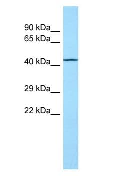 TOR1AIP2 Antibody (aa73-122)