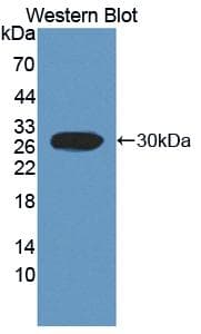 FCAR / CD89 Antibody (aa51-280, APC)