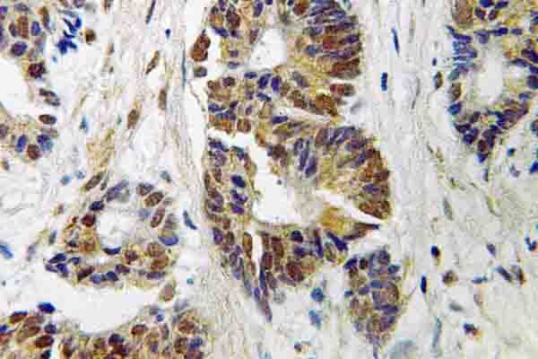 Polyclonal Rabbit anti-Human ADRBK1 / GRK2 Antibody (Val678, IHC, WB)