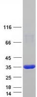 Human PRPS2 Protein (Recombinant Myc-DDK (Flag))