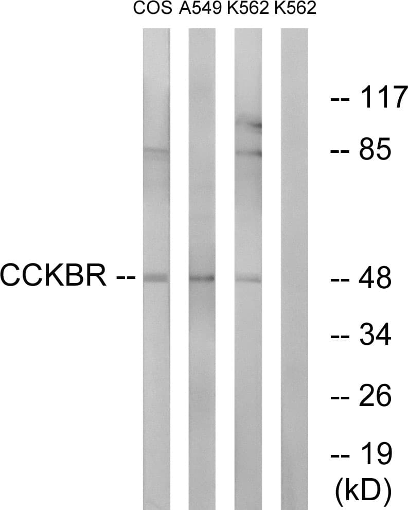 CCKBR / Cckb Antibody (aa11-60)