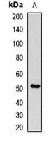 Polyclonal Rabbit anti-Human SRPX Antibody (WB)