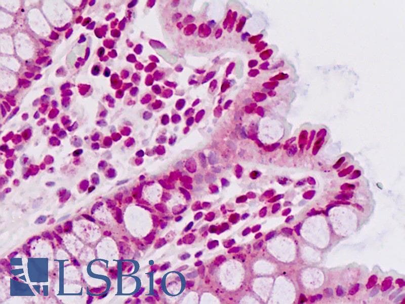 IHC-plus™ Polyclonal Rabbit anti-Human SMAD2 Antibody (Thr220, IHC, IF, WB)