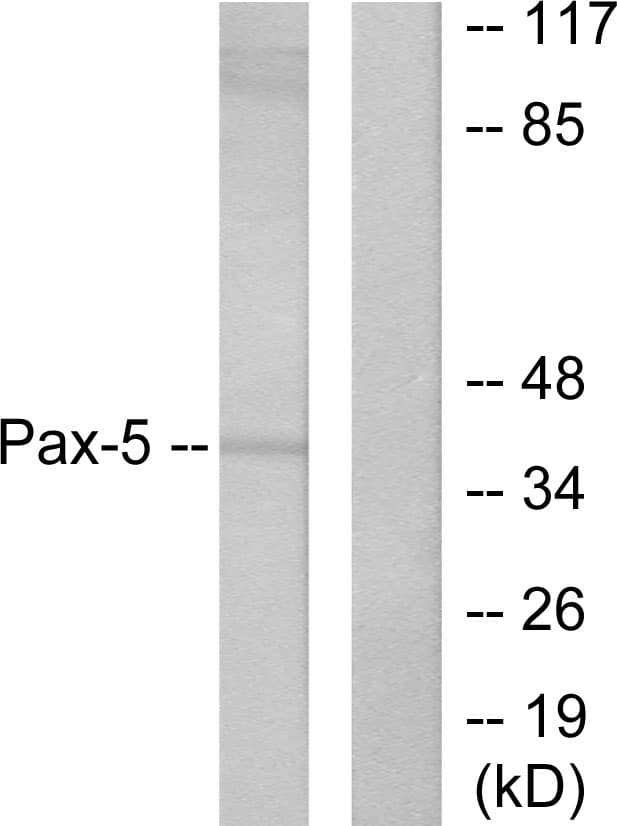 PAX5 Antibody (aa1-50)