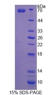 Rat Angiostatin Protein (Recombinant His-GST)