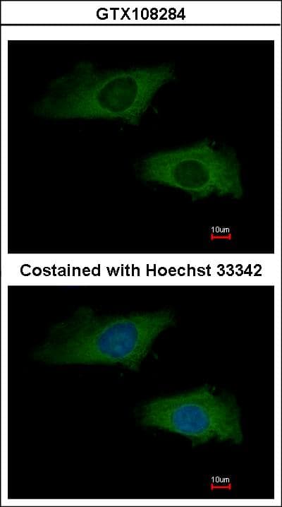 IHC-plus™ IFNA2 / Interferon Alpha 2 Antibody (aa125-188)