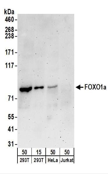 FOXO1 / FKHR Antibody (aa600-C-term)