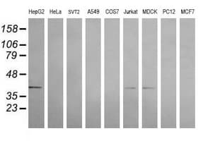 MAP2K3 / MEK3 / MKK3 Antibody (clone OTI5C9)