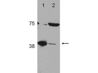 POLB / DNA Polymerase Beta Antibody (C-Terminus)