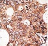 Polyclonal Rabbit anti-Human MAGE10 / MAGEA10 Antibody (aa324-353, IHC, WB)