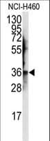 AIMP2 Antibody (aa156-184)