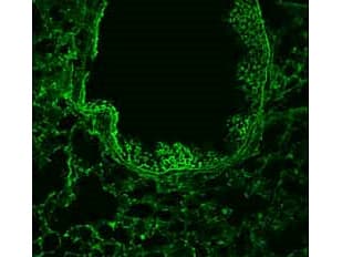IHC-plus™ ROBO1 Antibody (aa1625-1650)