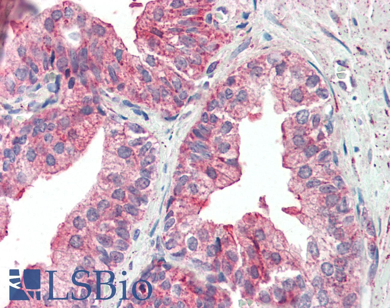 IHC-plus™ KIF6 Antibody (aa177-190)