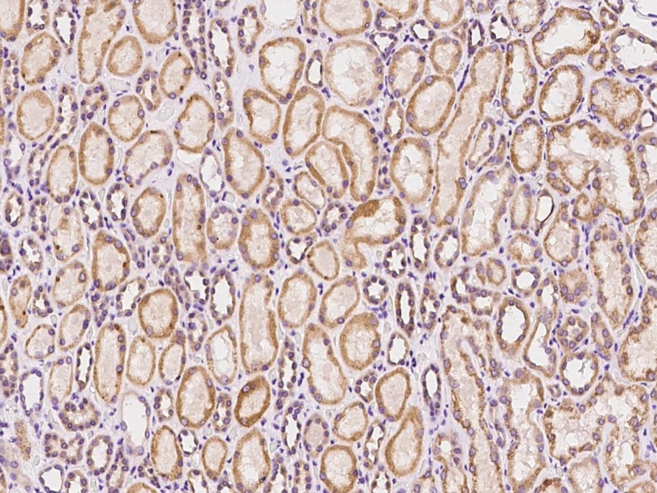 Polyclonal Rabbit anti-Human SACM1L / SAC1 Antibody (IHC, IF)