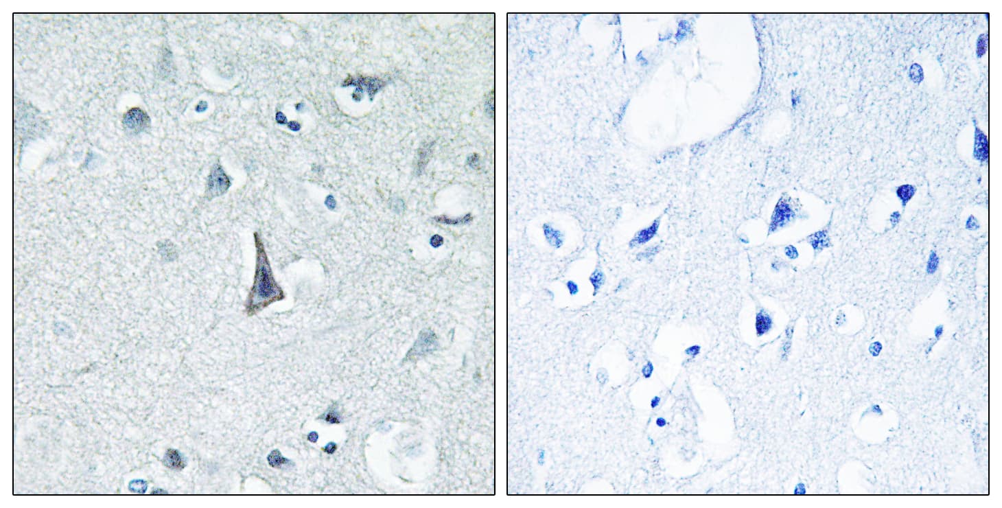 CYP3A4 / Cytochrome P450 3A4 Antibody