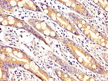 Polyclonal Rabbit anti-Human ARHGAP18 Antibody (IHC, WB)