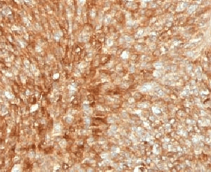 B2M / Beta 2 Microglobulin Antibody (clone MGBP2-1, Ready-to-Use)