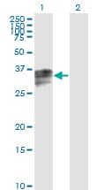 Monoclonal Mouse anti-Human HPX / Hemopexin Antibody (clone 3A9-1A9, WB)