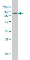 LAMB3 / Laminin Beta 3 Antibody (clone 2G10)