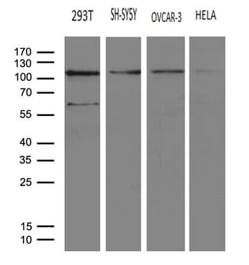 Monoclonal Mouse anti-Human HACE1 Antibody (clone OTI6H8, WB)