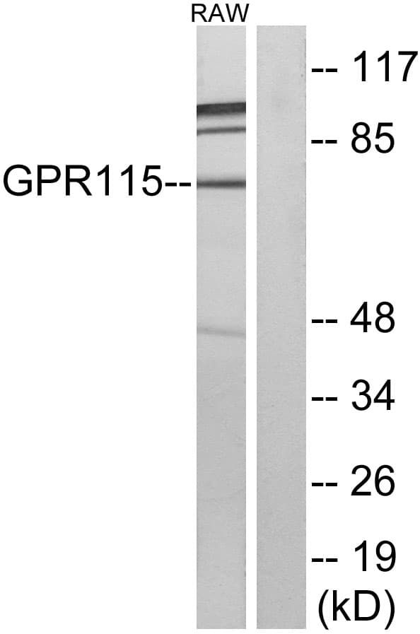 ADGRF4 / GPR115 Antibody (aa641-690)