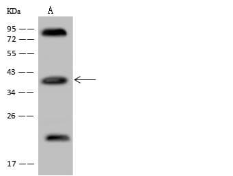 APOL2 / Apolipoprotein L 2 Antibody