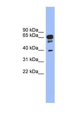 HTR5A / 5-HT5A Receptor Antibody (N-Terminus)
