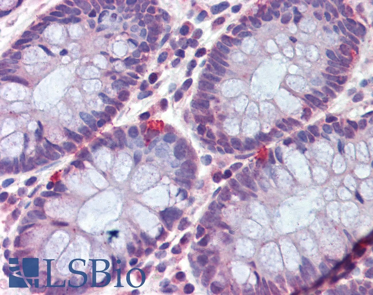 IHC-plus™ VIP Antibody (aa139-167)