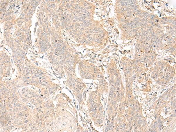 GLIS1 Antibody
