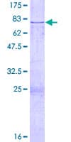 Human CFH / Complement Factor H Protein (Recombinant GST)