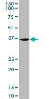 IHC-plus™ FZR1 Antibody (clone 4C4)