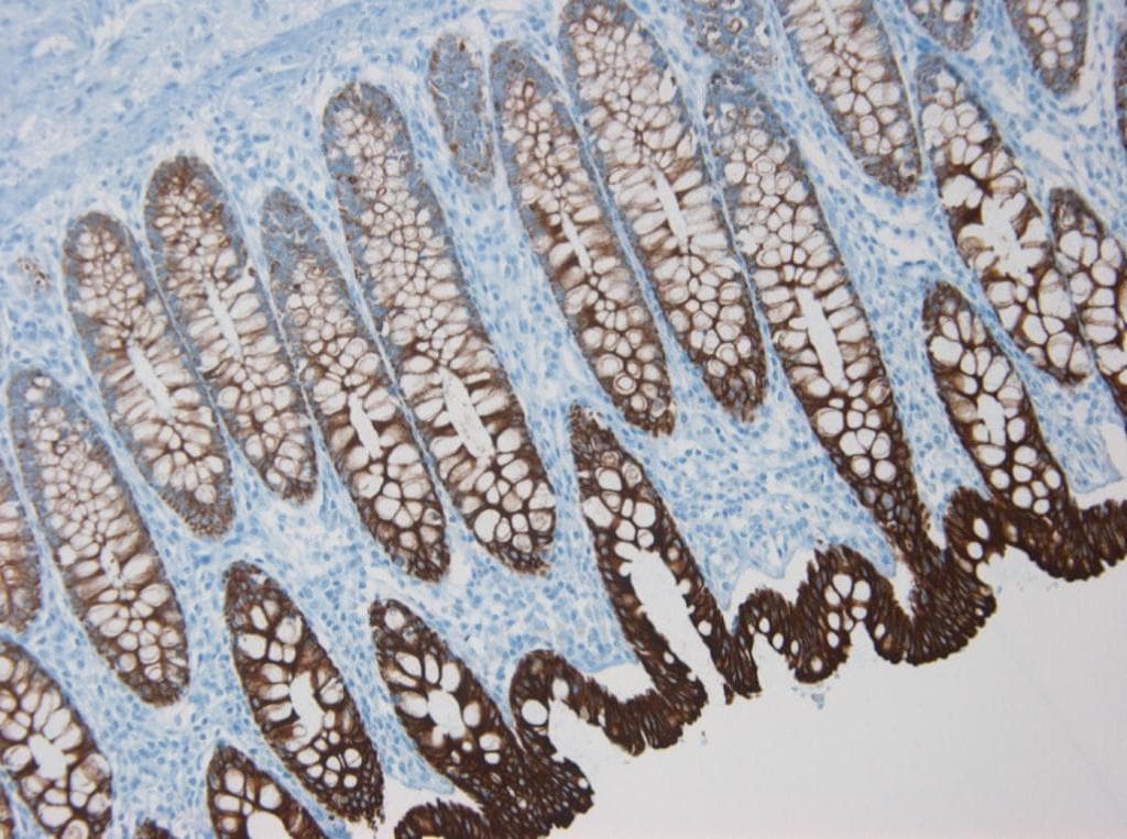 IHC-plus™ KRT8 / CK8 / Cytokeratin 8 Antibody (clone M20)