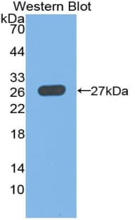 ICA69 / ICA1 Antibody (aa1-258)
