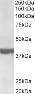 IHC-plus™ SH3GL2 Antibody (aa262-274)