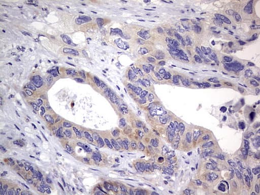 PRX-1 / PRRX1 Antibody (clone OTI1E10)