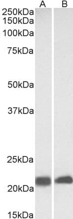 IHC-plus™ Polyclonal Goat anti-Human CAV3 / Caveolin 3 Antibody (aa5-18, IHC, WB)