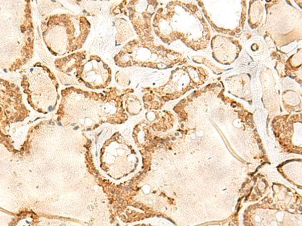 HN1 / ARM2 Antibody